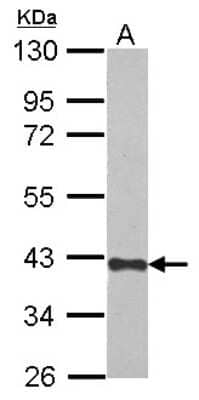 Western Blot: Zhangfei Antibody [NBP2-20954]