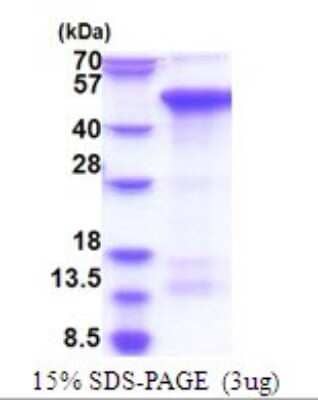 SDS-PAGE: Recombinant Human Zhangfei His Protein [NBP2-51824]