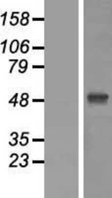 Western Blot: ZIC1 Overexpression Lysate [NBP2-08012]