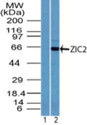 Western Blot: Zic2 Antibody [NBP2-24607]