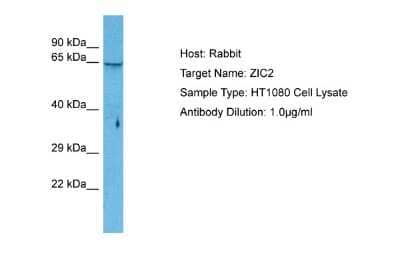 Western Blot: Zic2 Antibody [NBP2-86425]