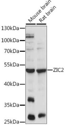 Western Blot: Zic2 AntibodyAzide and BSA Free [NBP2-93517]