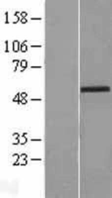 Western Blot: Zic2 Overexpression Lysate [NBL1-18034]