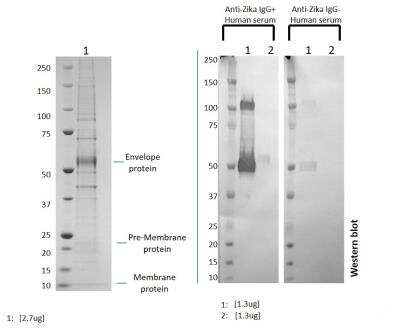 SDS-PAGE: Recombinant Virus Zika Virus VLP Suriname Z1106033 Protein [NBP3-14835]