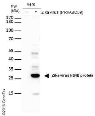 Western Blot: Zika virus NS4B Antibody [NBP3-13197]