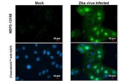 Immunocytochemistry/ Immunofluorescence: Zika virus NS5 Antibody [NBP3-13198]
