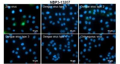 Immunocytochemistry/ Immunofluorescence: Zika virus NS5 Antibody [NBP3-13207]