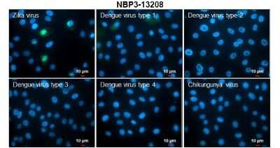 Immunocytochemistry/ Immunofluorescence: Zika virus NS5 Antibody [NBP3-13208]
