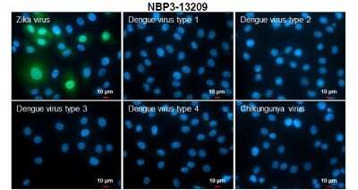 Immunocytochemistry/ Immunofluorescence: Zika virus NS5 Antibody [NBP3-13209]