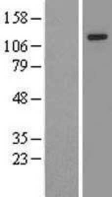 Western Blot: ZMIZ1/Zimp10 Overexpression Lysate [NBL1-18044]