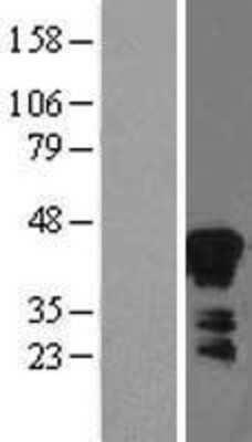 Western Blot: ZAG Overexpression Lysate [NBL1-07871]