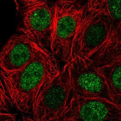 Immunocytochemistry/ Immunofluorescence: Zinc Finger And BTB Domain Containing 42 Antibody [NBP2-57401]