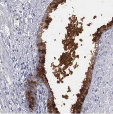 Immunohistochemistry: Zinc Finger And BTB Domain Containing 42 Antibody [NBP2-30994]