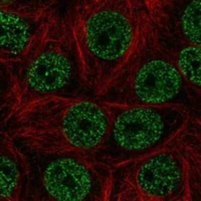 Immunocytochemistry/ Immunofluorescence: Zinc finger and BTB domain-containing protein 9 Antibody [NBP3-17965]