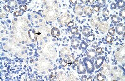 Immunohistochemistry: Zinc finger and BTB domain-containing protein 9 Antibody [NBP2-88629]