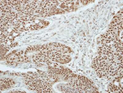 Immunohistochemistry-Paraffin: Zinc finger and BTB domain-containing protein 9 Antibody [NBP2-20956]