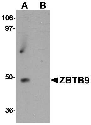 Western Blot: Zinc finger and BTB domain-containing protein 9 AntibodyBSA Free [NBP1-76522]