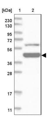 Western Blot: Zinc finger and BTB domain-containing protein 9 Antibody [NBP1-92611]