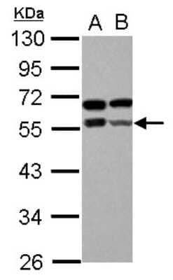 Western Blot: Zinc finger and BTB domain-containing protein 9 Antibody [NBP2-20956]