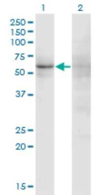 Western Blot: Zinc finger protein 180 Antibody (4F3) [H00007733-M01]