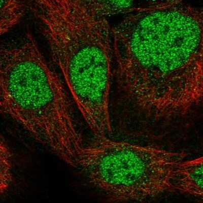 Immunocytochemistry/ Immunofluorescence: Zinc finger protein 180 Antibody [NBP1-92613]