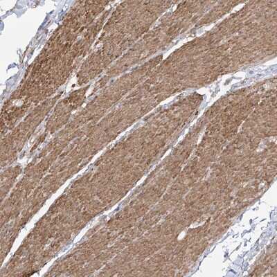 Immunohistochemistry-Paraffin: Zinc finger protein 180 Antibody [NBP1-92612]