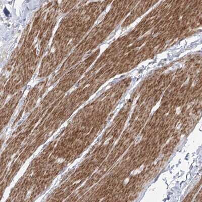 Immunohistochemistry-Paraffin: Zinc finger protein 180 Antibody [NBP1-92613]