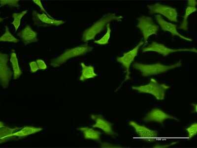 Immunocytochemistry/ Immunofluorescence: Zinc finger protein 287 Antibody (3A2) [H00057336-M08]