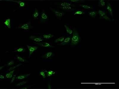 Immunocytochemistry/ Immunofluorescence: Zinc finger protein 287 Antibody (3A2) [H00057336-M08]