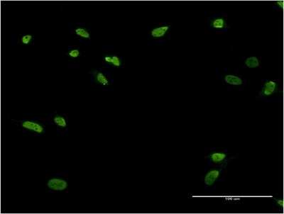 Immunocytochemistry/ Immunofluorescence: Zinc finger protein 287 Antibody (3E12) [H00057336-M11]