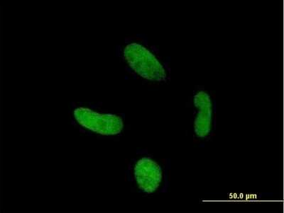 Immunocytochemistry/ Immunofluorescence: Zinc finger protein 287 Antibody [H00057336-B01P]
