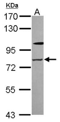 Western Blot: Zinc finger protein 287 Antibody [NBP2-20957]