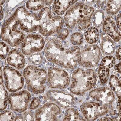 Immunohistochemistry-Paraffin: Zinc finger protein 324B Antibody [NBP1-92614]