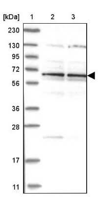 Western Blot: Zinc finger protein 324B Antibody [NBP1-92614]