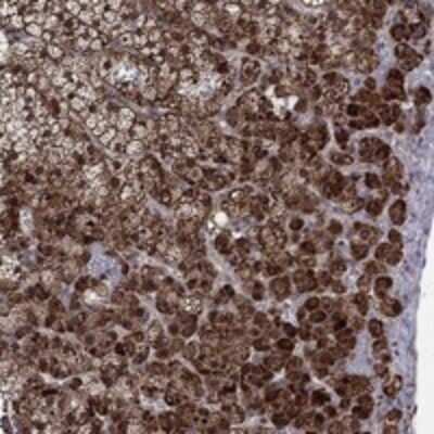 Immunohistochemistry-Paraffin: Zinc finger protein 395 Antibody [NBP3-17459]