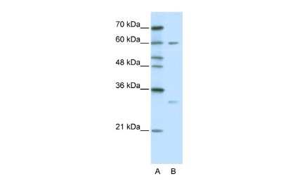 Western Blot: Zinc finger protein 395 Antibody [NBP3-10967]