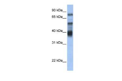 Western Blot: Zinc finger protein 395 Antibody [NBP3-10968]