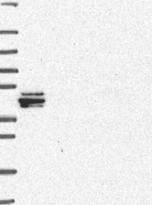 Western Blot: Zinc finger protein 395 Antibody [NBP3-17459]