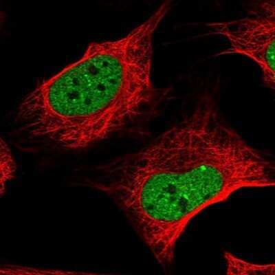 Immunocytochemistry/ Immunofluorescence: Zinc finger protein 470 Antibody [NBP1-84324]