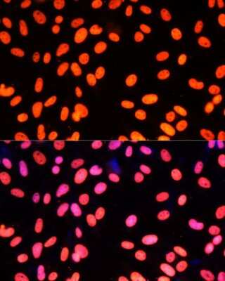 Immunocytochemistry/ Immunofluorescence: Zinc finger protein 581 Antibody - Azide and BSA Free [NBP2-94501]