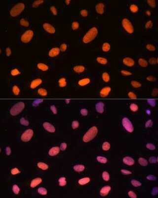 Immunocytochemistry/ Immunofluorescence: Zinc finger protein 581 Antibody - Azide and BSA Free [NBP2-94501]