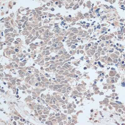 Immunohistochemistry-Paraffin: Zinc finger protein 581 Antibody - Azide and BSA Free [NBP2-94501]