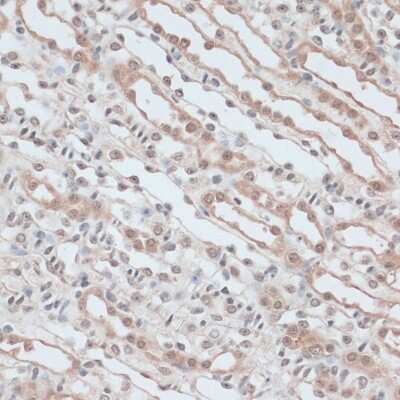 Immunohistochemistry-Paraffin: Zinc finger protein 581 Antibody - Azide and BSA Free [NBP2-94501]