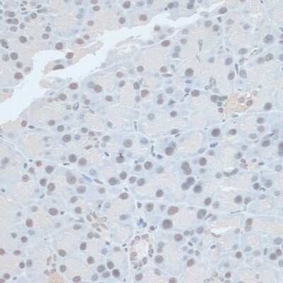 Immunohistochemistry-Paraffin: Zinc finger protein 581 Antibody - Azide and BSA Free [NBP2-94501]