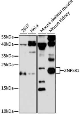 Western Blot: Zinc finger protein 581 AntibodyAzide and BSA Free [NBP2-94501]