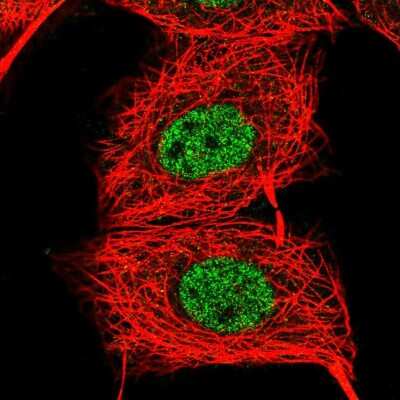 Immunocytochemistry/ Immunofluorescence: Zinc finger protein 639 Antibody [NBP2-47571]