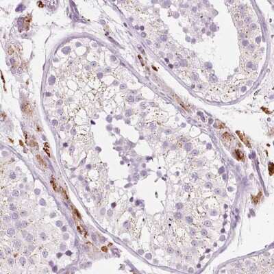 Immunohistochemistry-Paraffin: Zinc finger protein 639 Antibody [NBP2-49035]