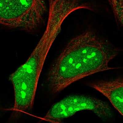 Immunocytochemistry/ Immunofluorescence: Zinc finger protein 668 Antibody [NBP1-92615]