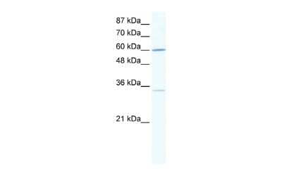 Western Blot: Zinc finger protein 668 Antibody [NBP2-86427]