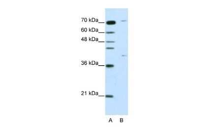 Western Blot: Zinc finger protein 668 Antibody [NBP2-86428]